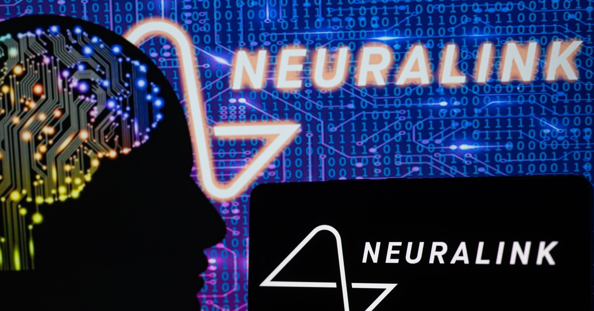 $ 650 million for neuralinks. Elon Muska's breakthrough implant enters the clinical trial phase